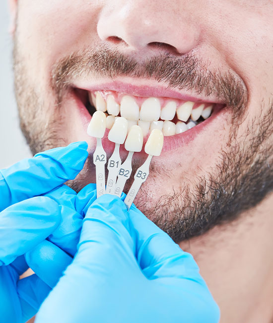 Downtown Dental | Oral Exams, Veneers and Root Canals