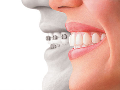 Downtown Dental CT | Digital Radiography, CBCT and Invisalign reg