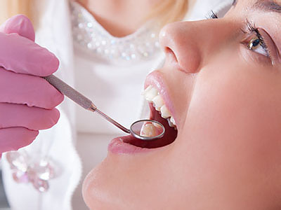 Downtown Dental CT | Oral Cancer Screening, Root Canals and Ceramic Crowns